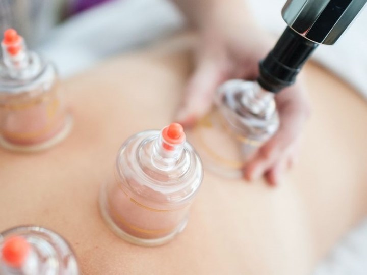 DRY CUPPING THERAPY 